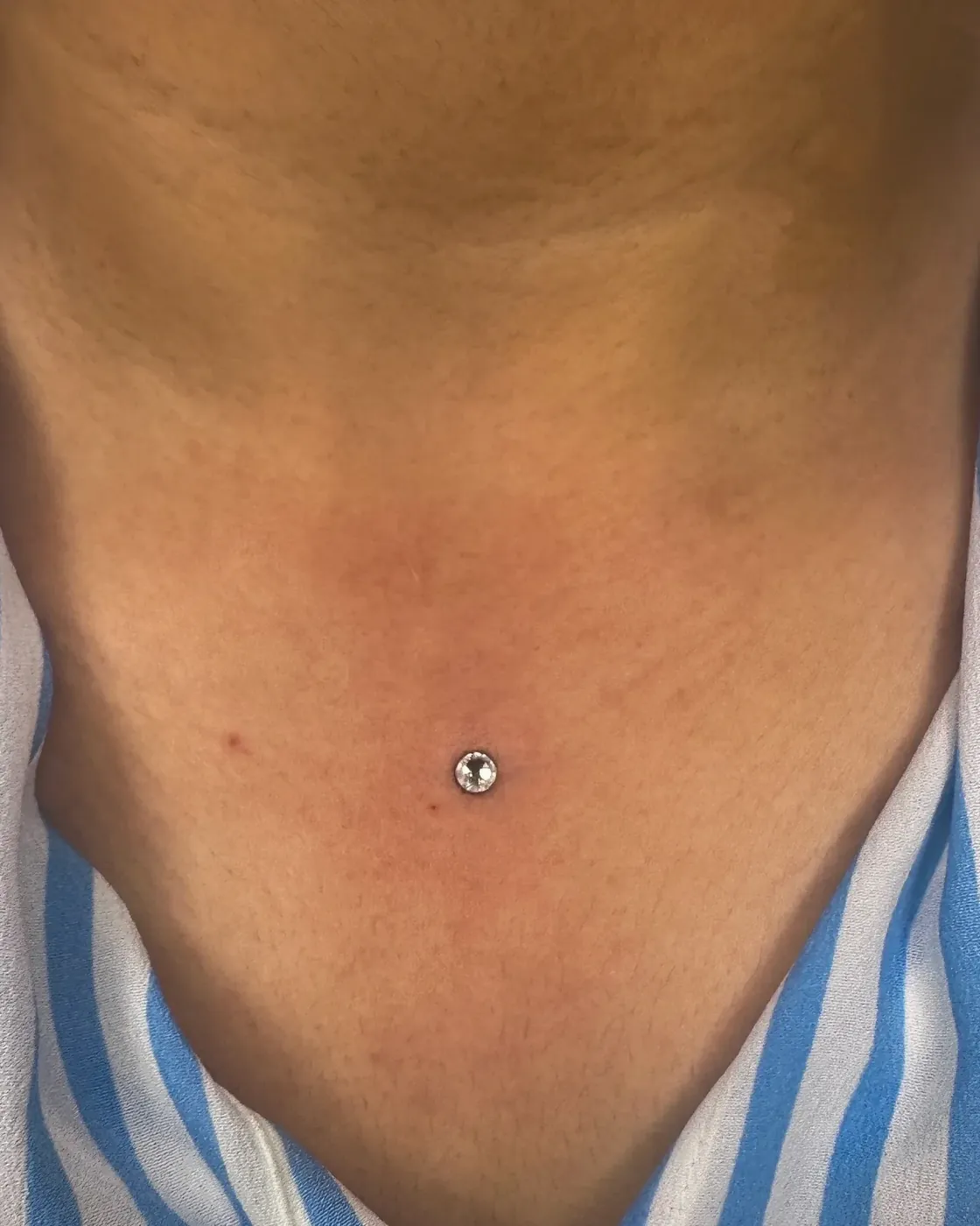 Sternum dermal piercing with implant grade titanium anchor at Rebel Tattoos Gurgaon